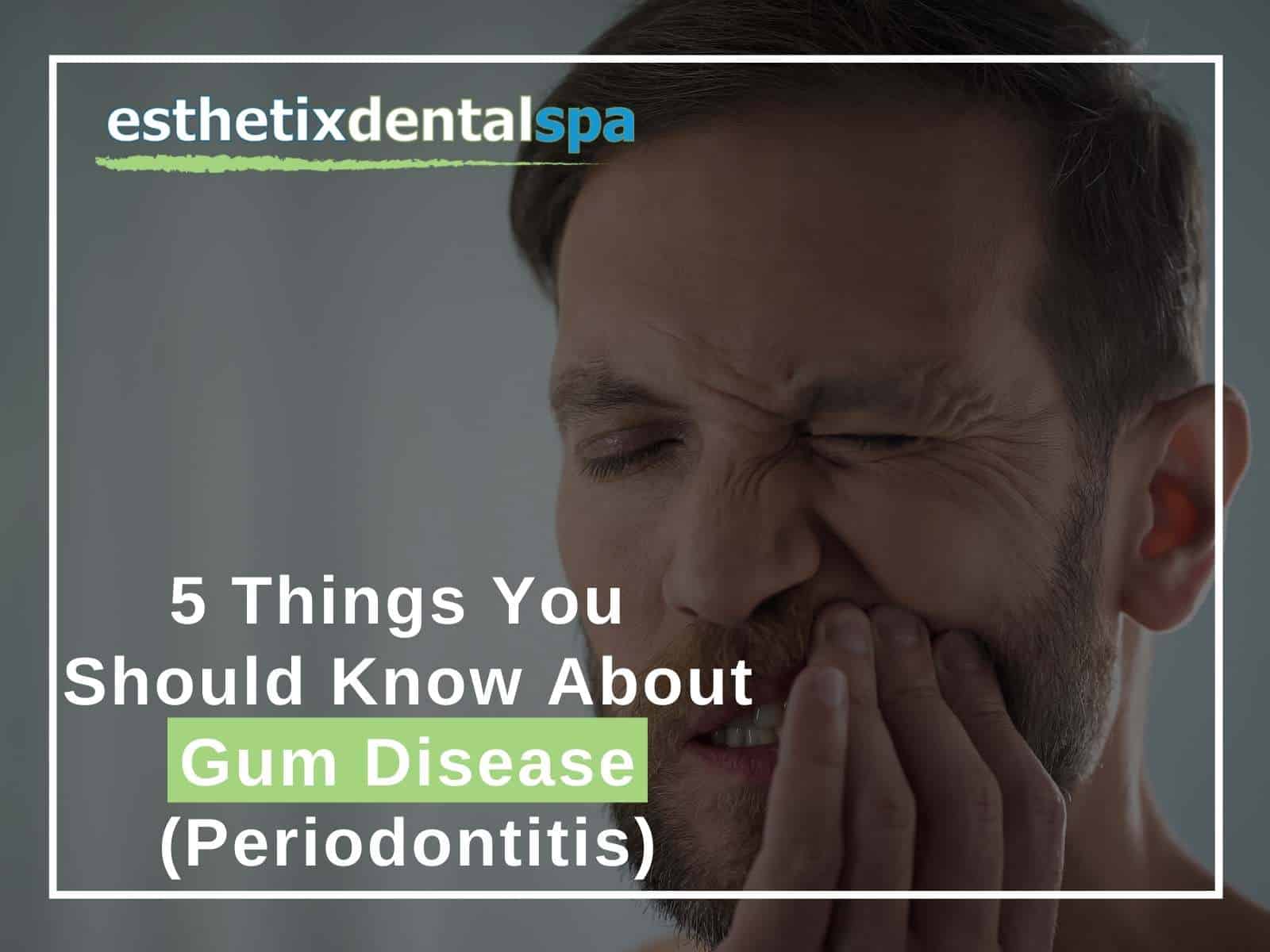 5 Things You Should Know About Gum Disease (Periodontitis)