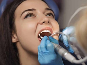 Professional Teeth Cleaning Dentists In Washington Heights, NY