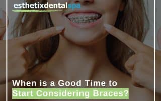 When is a Good Time to Start Considering Braces