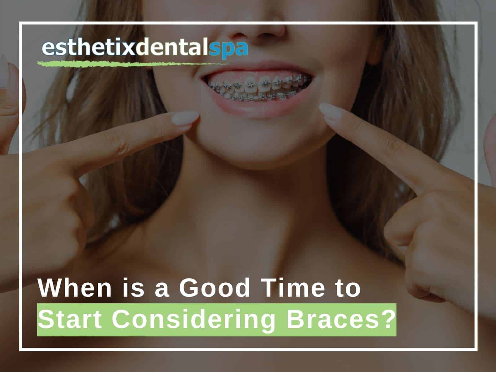 When is a Good Time to Start Considering Braces