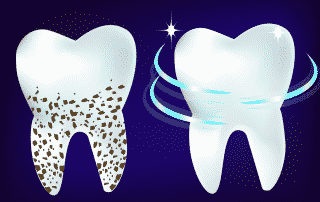 Preventative Dentistry