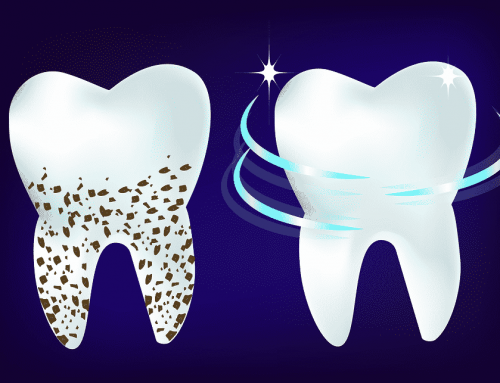 Holistic Dentistry