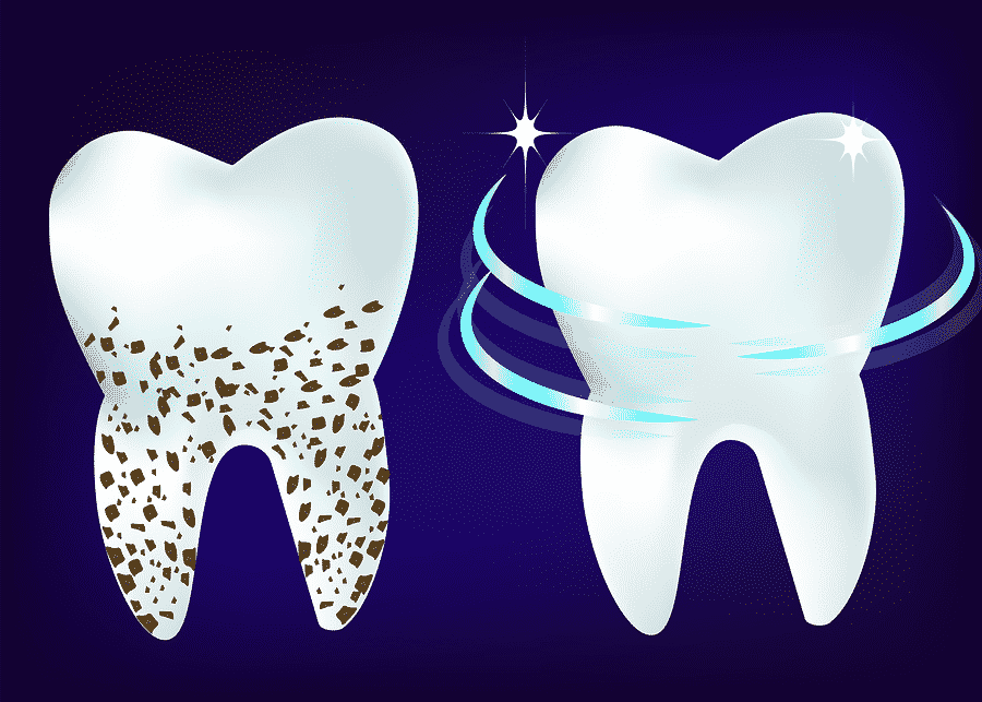 Preventative Dentistry