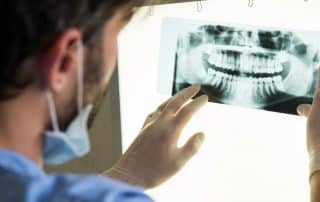Everything You Need to Know About Dental X-Rays dentist washington heights ny