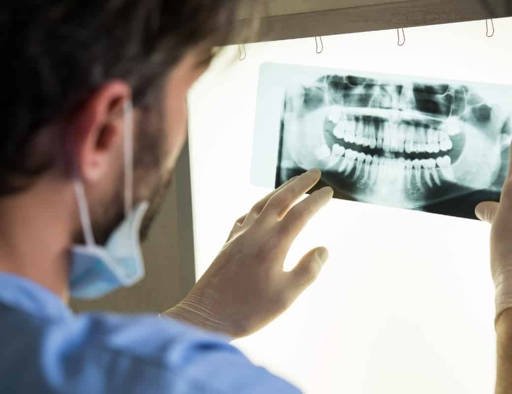 Everything You Need to Know About Dental X-Rays dentist washington heights ny