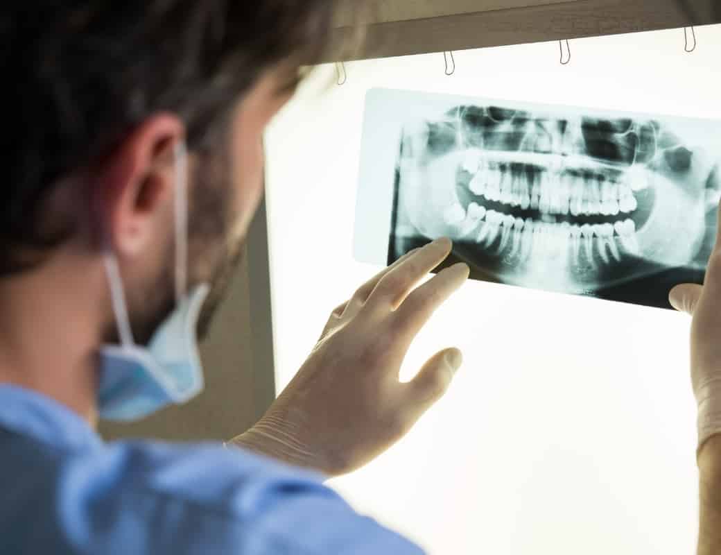 Understanding The Cost Of Dental Implants