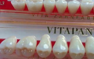 Restore Your Smile With Dental Implants washington heights nyc