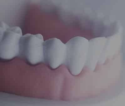 Porcelain Dental Crowns