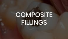 Composite Fillings