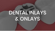 Dental Inlays & Onlays