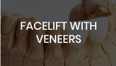 Facelift with Veneers