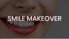 Smile Makeover