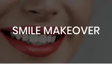 Smile Makeover