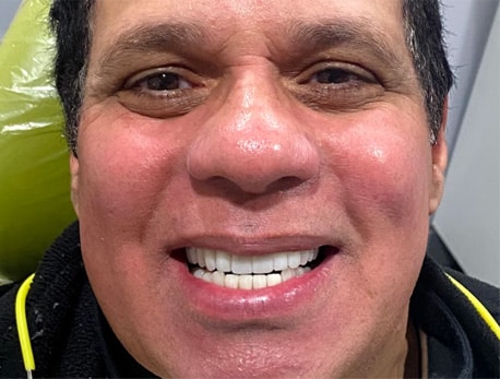 Joe After Dental Implants Treatment At Esthetix Dental Spa