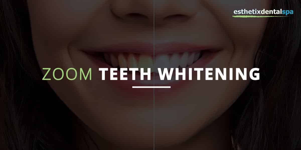 nyc zoom whitening nyc zoom whitening