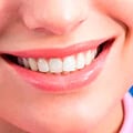 Dental Plastic Surgery