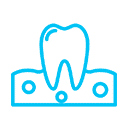 Periodontal Treatment For Gingivitis And Gum Diseases