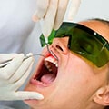 Laser Gum Surgery In Washington Heights