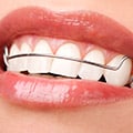 Teeth Alignment With Removable And Permanent Retainers