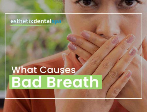 What Causes Bad Breath?