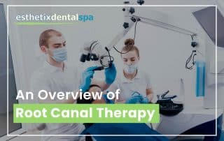 An Overview Of Root Canal Therapy