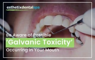 Be Aware Of Possible 'Galvanic Toxicity' Ocurring In Your Mouth