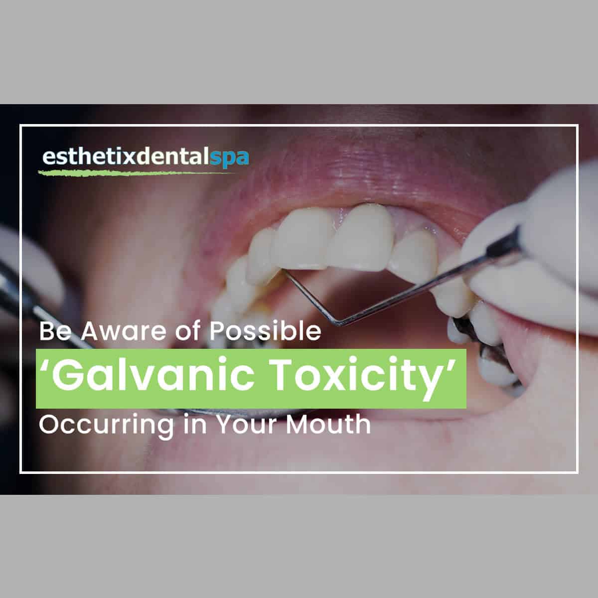 Be Aware Of Possible 'Galvanic Toxicity' Ocurring In Your Mouth