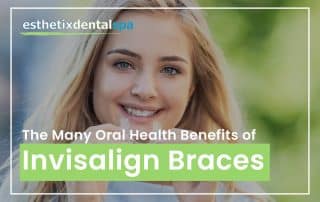 The Many Oral Health Benefits Of Invisalign Braces
