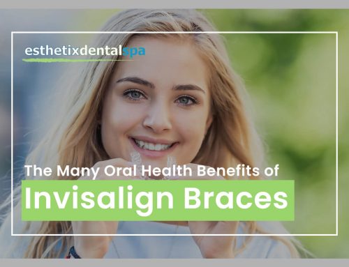The Many Oral Health Benefits Of Invisalign Braces
