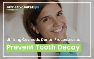 Utilizing Cosmetic Dental Procedures To Prevent Tooth Decay