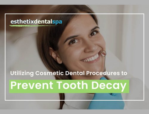 Utilizing Cosmetic Dental Procedures To Prevent Tooth Decay