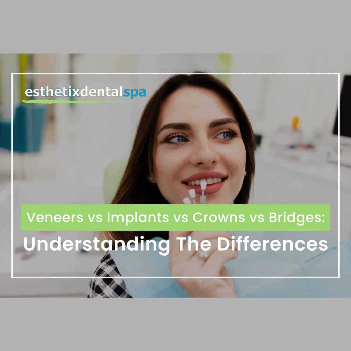 Veneers vs Implants vs Crowns vs Bridges: Understanding The Differences