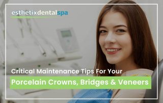 Critical Maintenance Tips For Your Porcelain Crowns, Bridges & Veneers