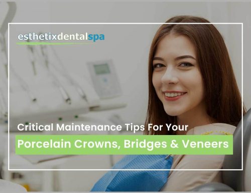 Critical Maintenance Tips For Your Porcelain Crowns, Bridges & Veneers
