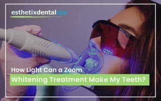 How Light Can a Zoom Whitening Treatment Make My Teeth?