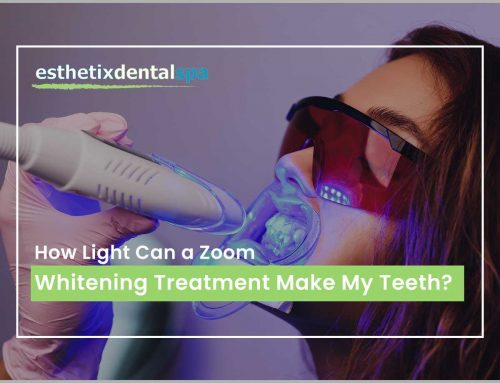 How Light Can a Zoom Whitening Treatment Make My Teeth?
