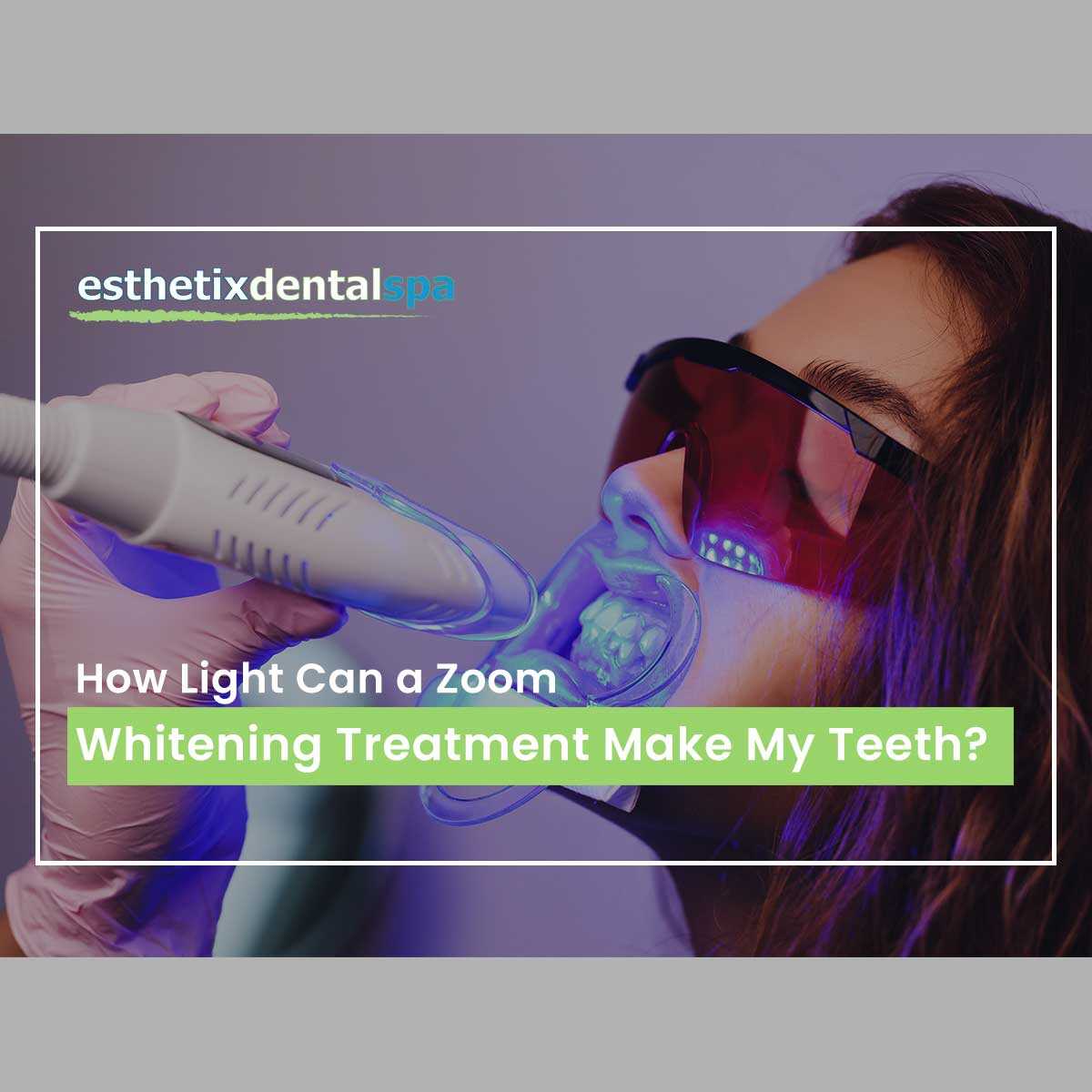 How Light Can a Zoom Whitening Treatment Make My Teeth?