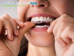 The Pros & Cons Of Invisalign Braces You Didn't Know