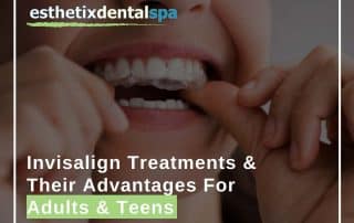 Invisalign Treatments & Their Advantages For Adults & Teens