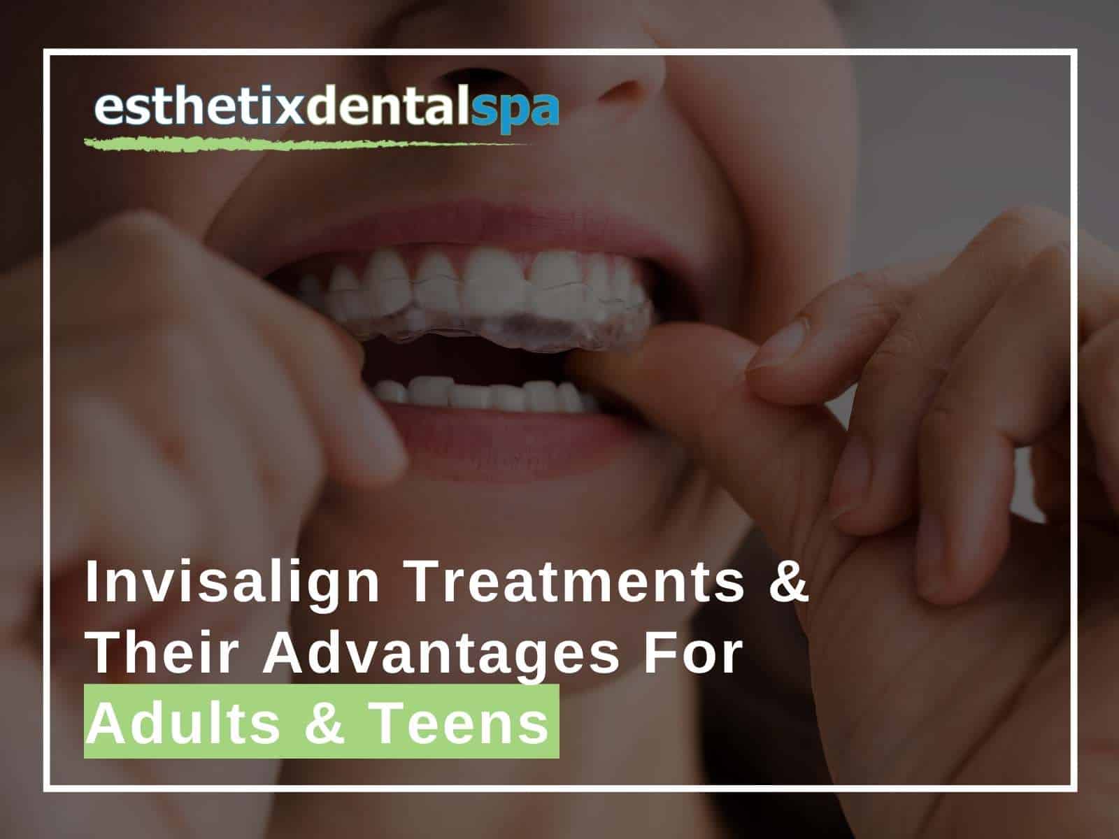 Invisalign Treatments & Their Advantages For Adults & Teens