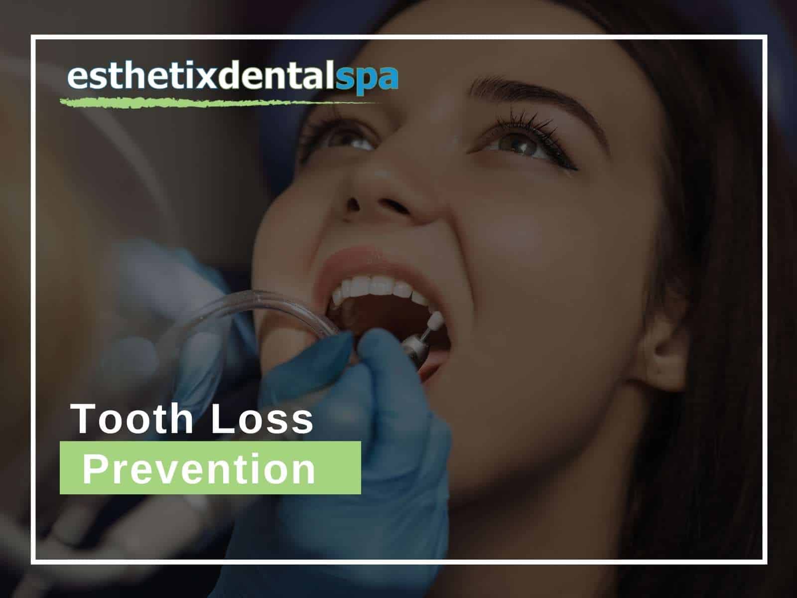 Tooth Loss Prevention