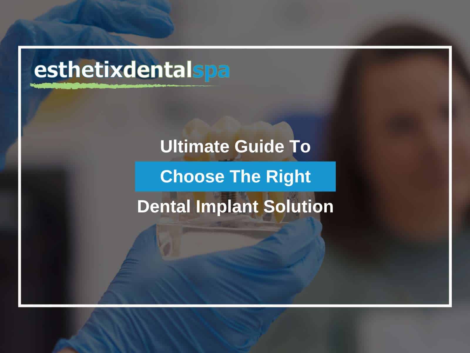 Ultimate Guide To Choose The Right Dental Implant Solution