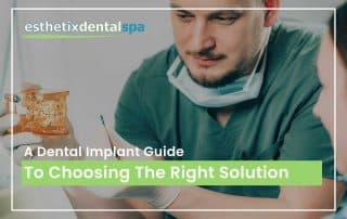 A Dental Implant Guide To Choosing The Right Solution