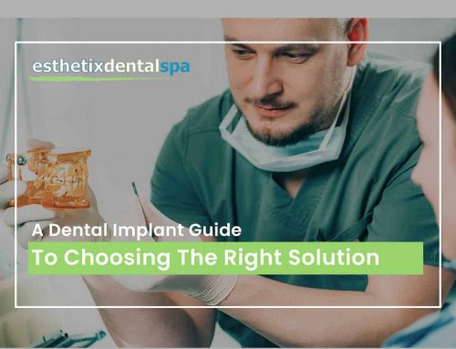 A Dental Implant Guide To Choosing The Right Solution