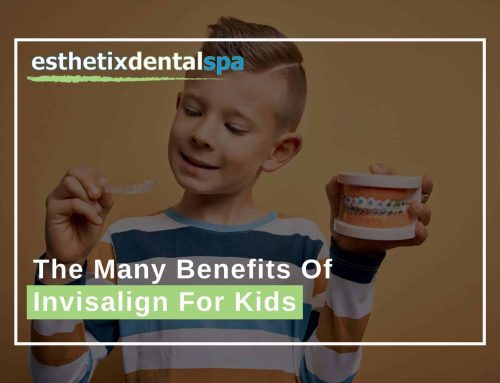 The Many Benefits Of Invisalign For Kids