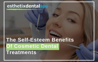 The Self-Esteem Benefits Of Cosmetic Dental Treatments