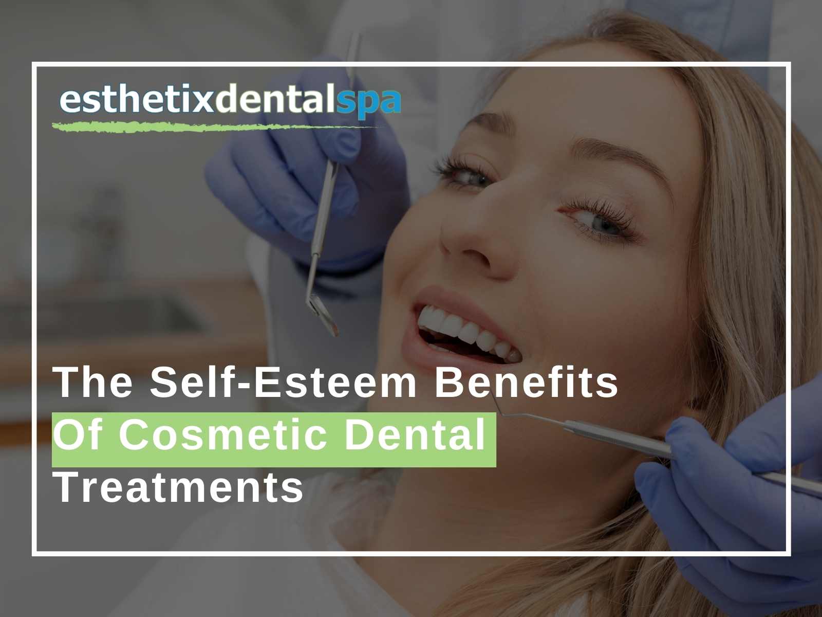 The Self-Esteem Benefits Of Cosmetic Dental Treatments