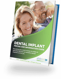 Guía De Información Y Precios Para Implantes Dentales