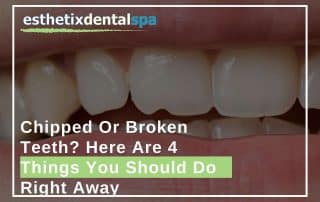 Chipped Or Broken Teeth Here Are 4 Things You Should Do Right Away