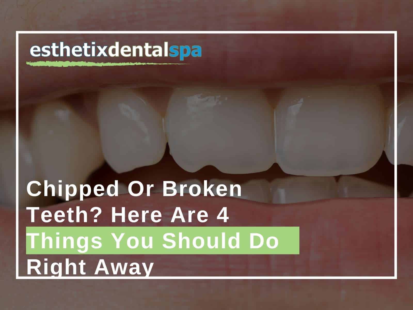 Chipped Or Broken Teeth Here Are 4 Things You Should Do Right Away